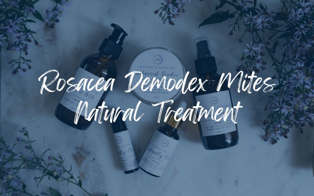 Demodex Mites Rosacea Treatment