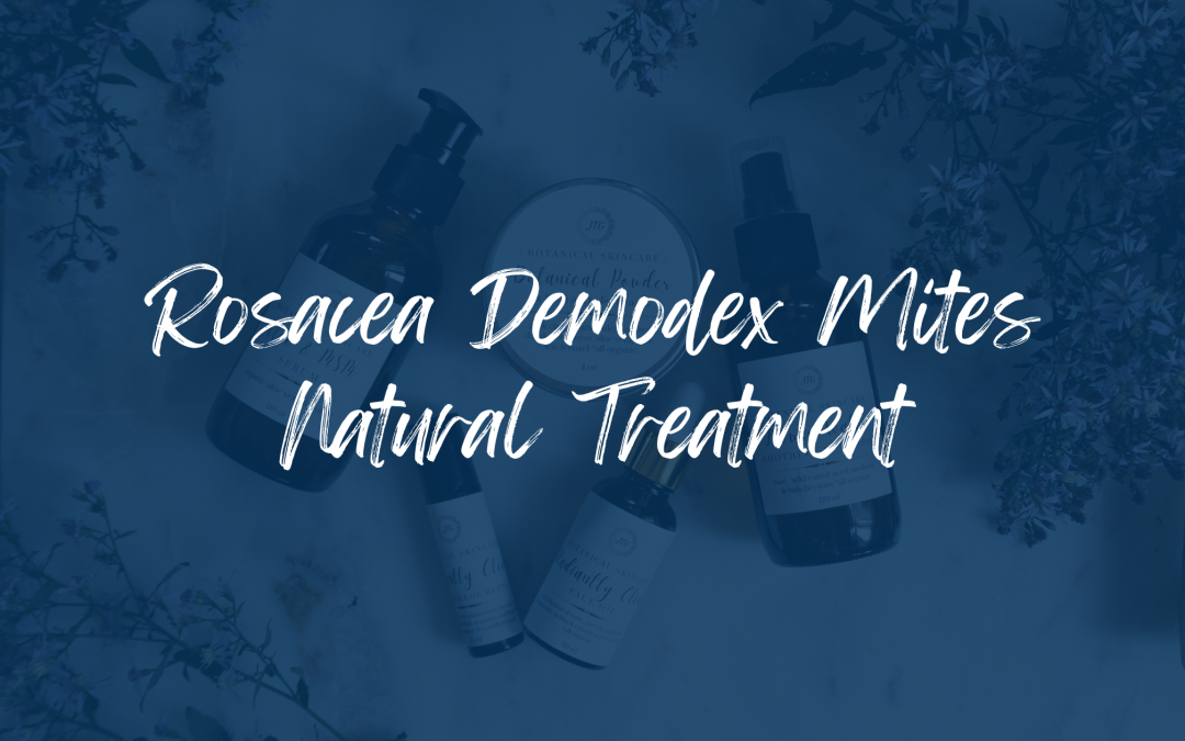 Demodex Mites Rosacea Treatment