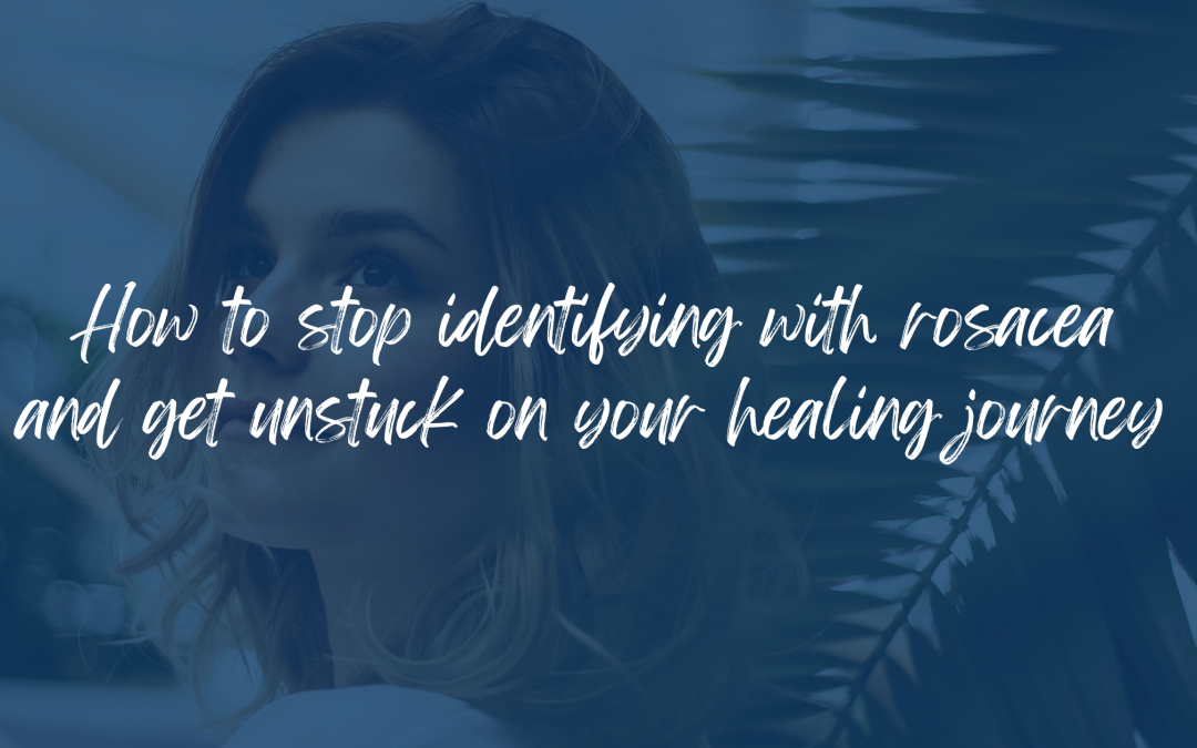 How to stop identifying with rosacea