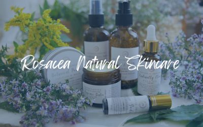 Natural skincare for rosacea