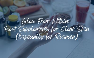 Glow From Within: Best Supplements For Clear Skin (Especially Rosacea)